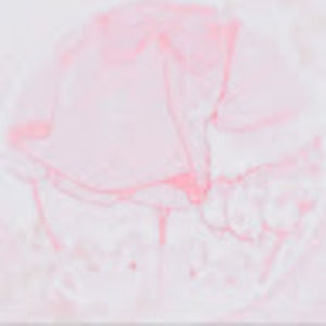 Meet your Posher, Strawberribunni